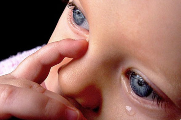 Чому у дитини сльозяться очі-1